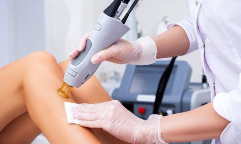 بهترین روشهای لیزر موهای زائد