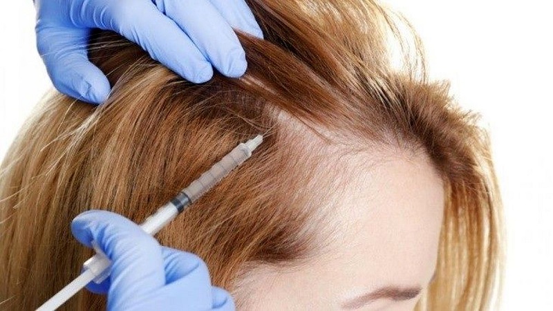 نحوه انجام PRP (پلاکت درمانی) | متخصص پوست اصفهان - بهترین متخصص ژل و بوتاکس - بهترین متخصص تزریق چربی و لیپوترانسفر
