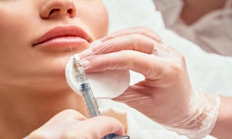 تقارن سازی لب ها با تزریق بوتاکس