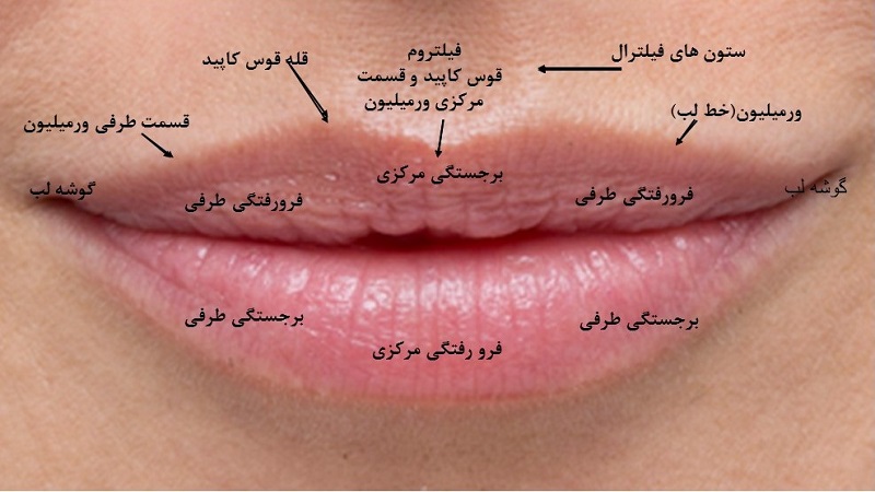تقارن سازی لب ها با تزریق بوتاکس | متخصص پوست اصفهان - بهترین متخصص ژل و بوتاکس - بهترین متخصص تزریق چربی و لیپوترانسفر