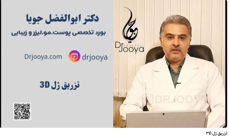 تزریق ژل 3D