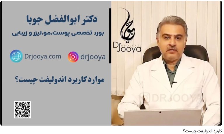 کلیپ یوتیوب کاربرد اندولیفت چیست؟