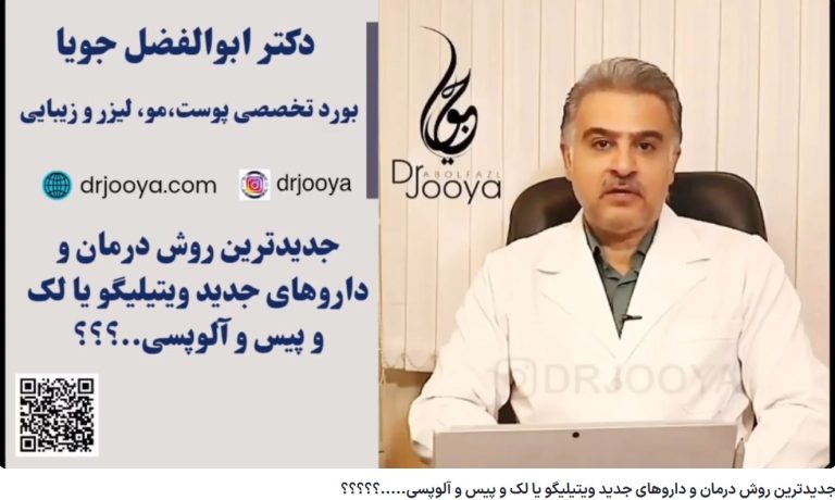 ویدئو آپارات جدیدترین روش درمان و داروهای جدید ویتیلیگو یا لک و پیس و آلوپسی…..؟؟؟؟؟