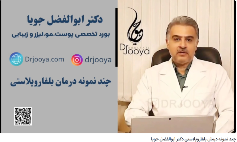 ویدئو آپارات چند نمونه درمان بلفاروپلاستی دکتر ابوالفضل جویا
