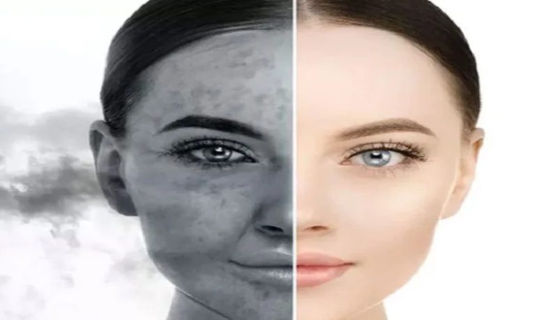تأثیر آلودگی هوا بر روی پوست