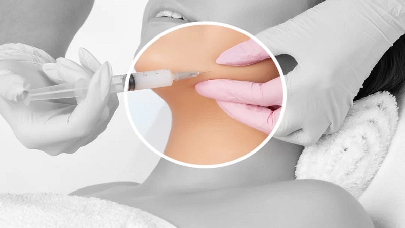 درمان ‌های غیر جراحی چربی زیر پوستی چیست؟ | متخصص پوست اصفهان - بهترین متخصص ژل و بوتاکس - بهترین متخصص تزریق چربی و لیپوترانسفر