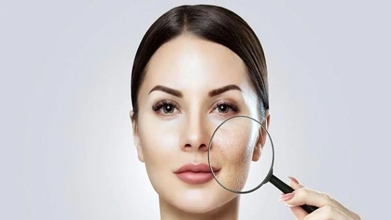 دکتر ابوالفضل جویا | بهترین متخصص پوست در اصفهان، بهترین متخصص ژل و بوتاکس، بهترین متخصص تزریق چربی و لیپوترانسفر