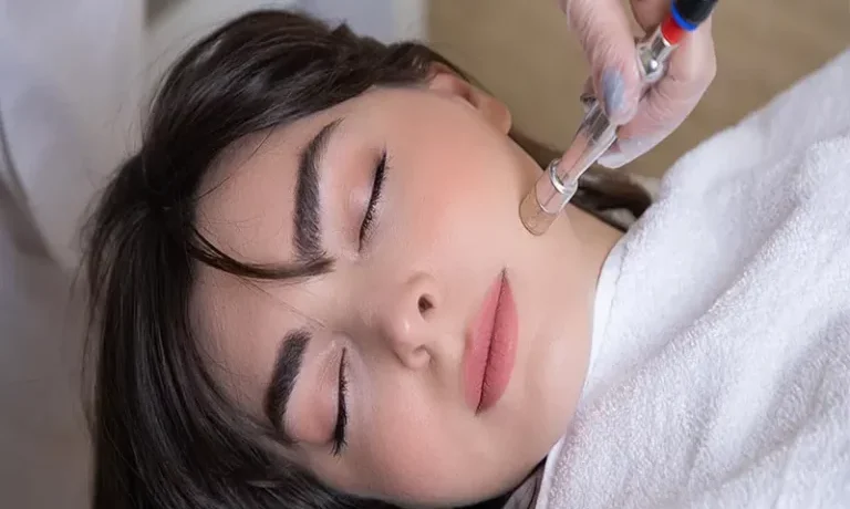 روش های مختلف میکرودرم ابریژن