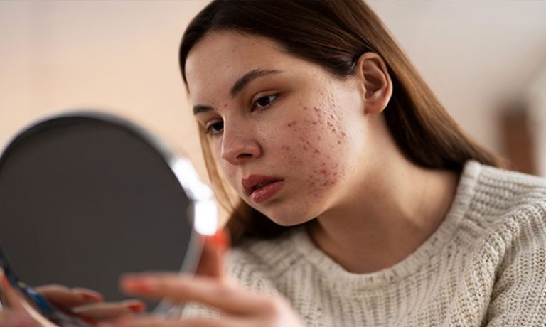 عوارض روانی ناشی از مشکلات پوستی