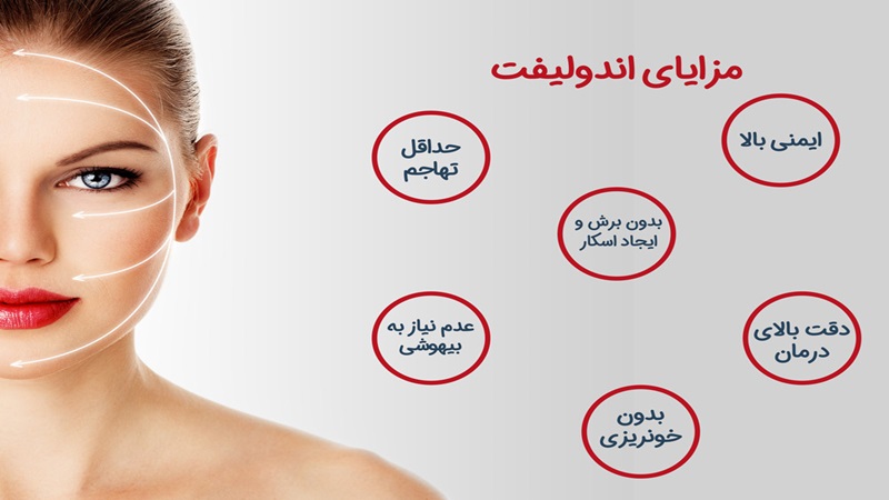 مزایا و معایب اندولیفت | متخصص پوست اصفهان - بهترین متخصص ژل و بوتاکس - بهترین متخصص تزریق چربی و لیپوترانسفر | دکتر ابوالفضل جویا