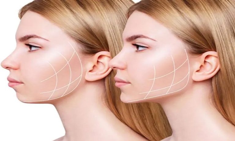 چگونه می توان تخلیه چربی صورت را انجام داد؟