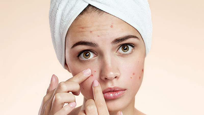 دکتر ابوالفضل جویا | بهترین متخصص پوست در اصفهان، بهترین متخصص ژل و بوتاکس، بهترین متخصص تزریق چربی و لیپوترانسفر