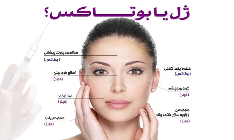 تزریق ژل و بوتاکس چه تفاوتی با هم دارند؟